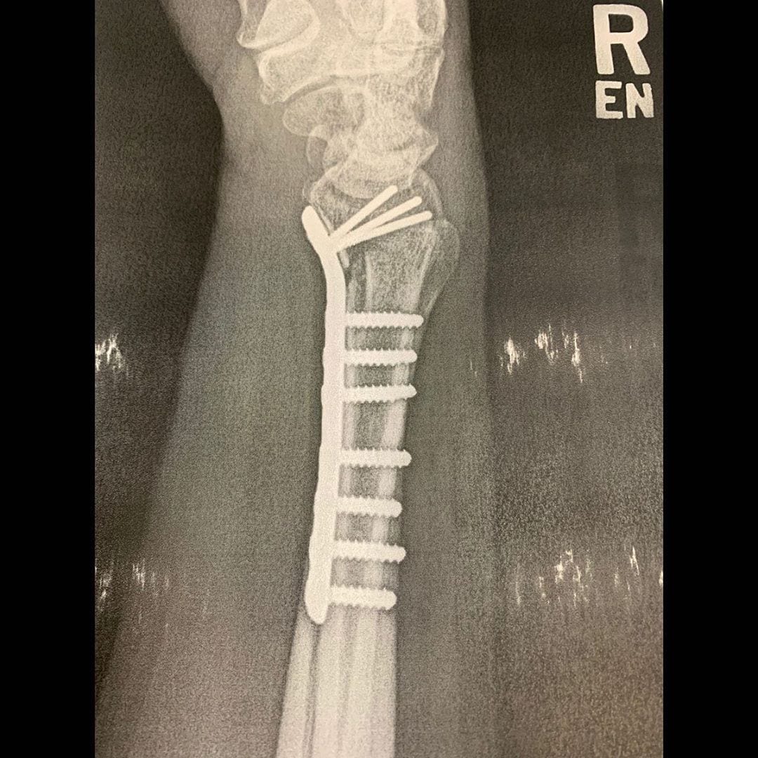 Mind you, this x-ray is the right arm of a pianist